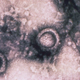 Imagen coloreada que muestra varias partículas del virus del Herpes